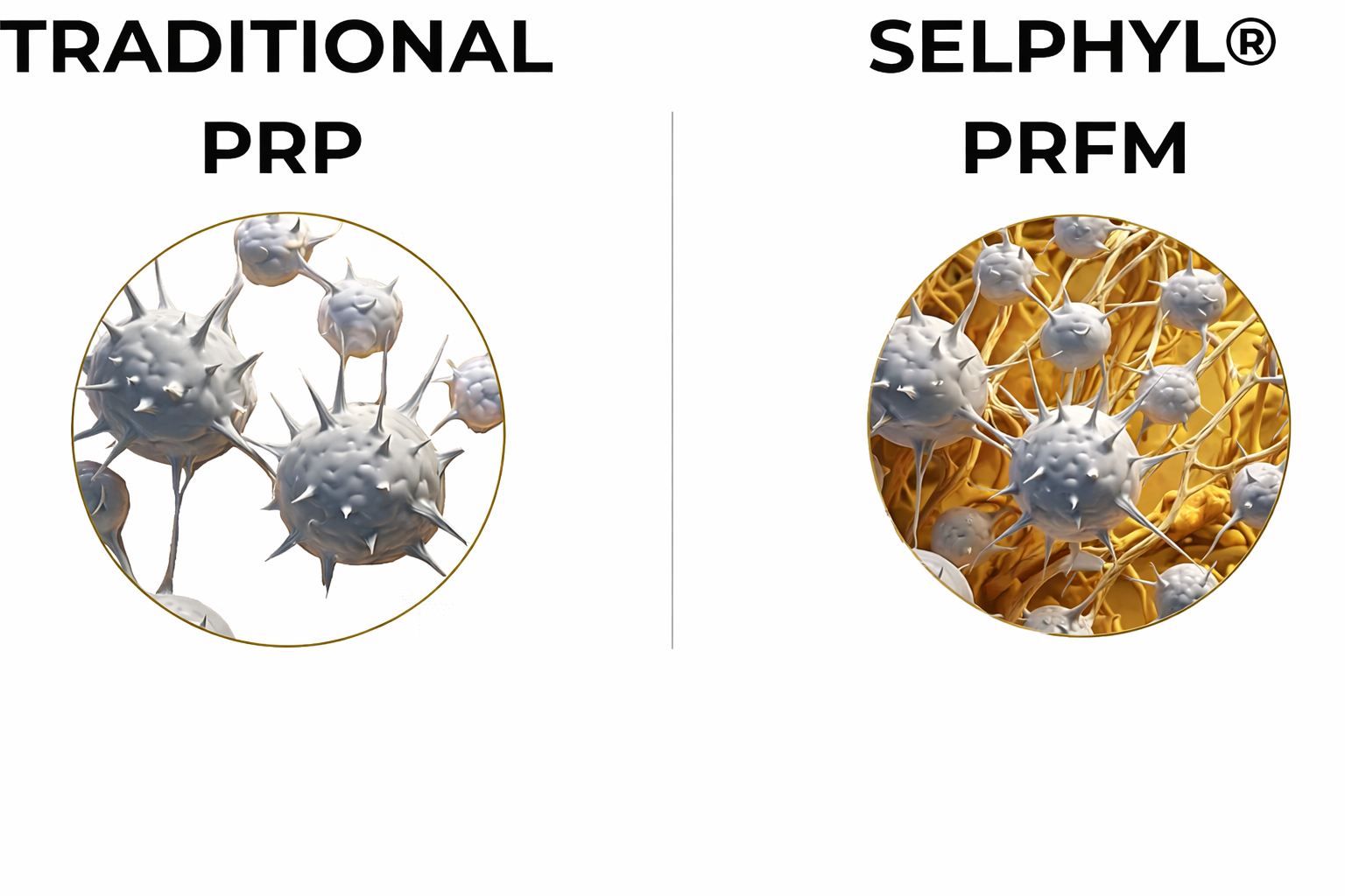 PRP vs Selphyl Comparison